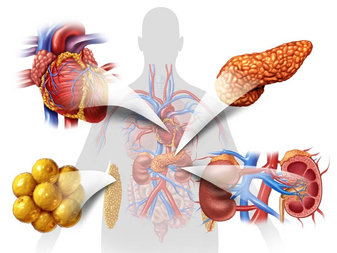 Phthisiology and metabolic diseases
