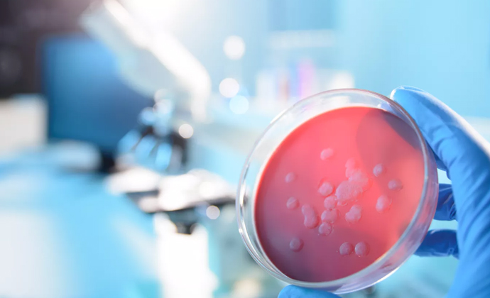  Infectious Diseases